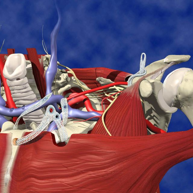 Claviculoplasty Fig 2  (Primal Pics).JPG (911108 bytes)